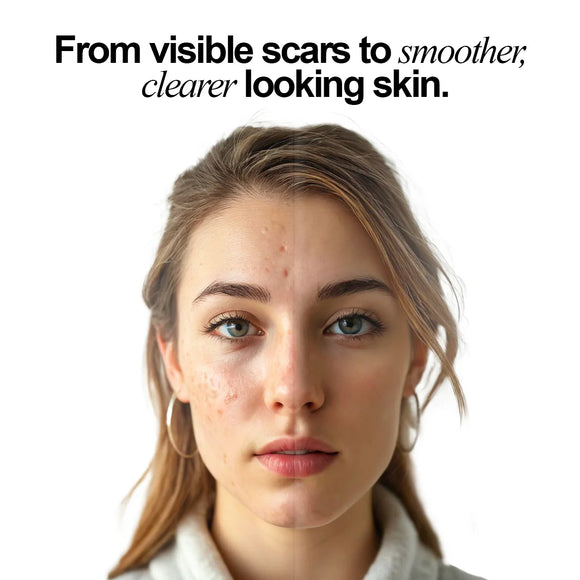 Feature product image