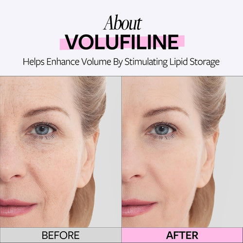 100% Volufiline Ampoule